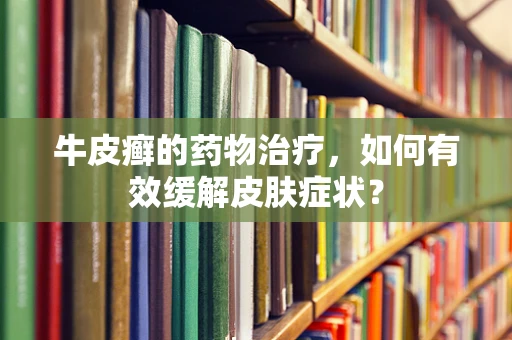 牛皮癣的药物治疗，如何有效缓解皮肤症状？