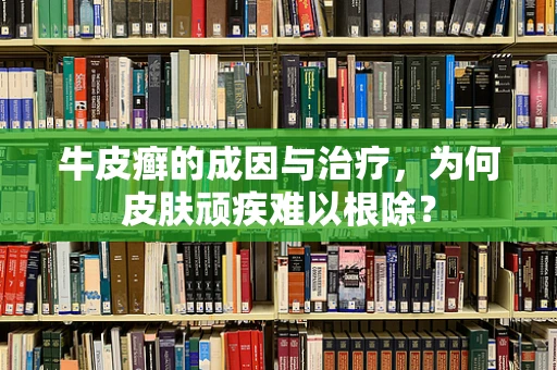 牛皮癣的成因与治疗，为何皮肤顽疾难以根除？